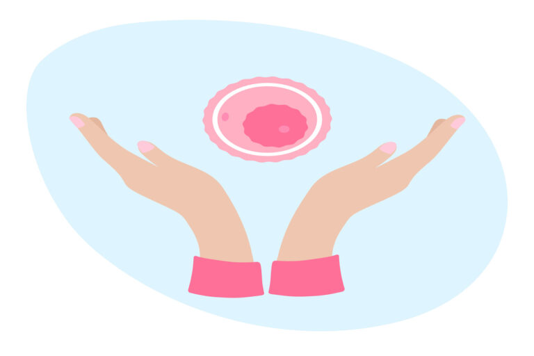 What is the Wait Time to Be Matched With an Egg Donor?